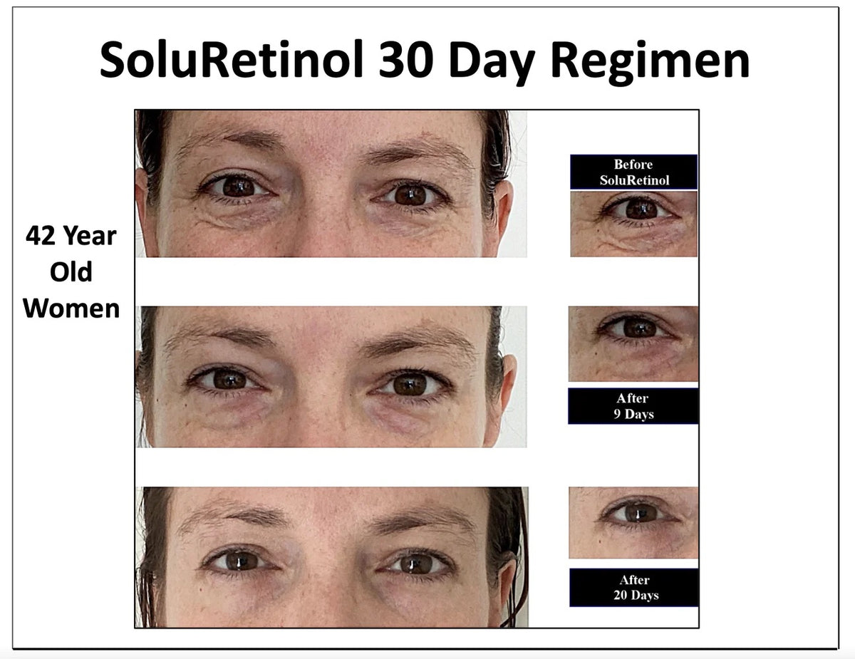 SOLURETINOL