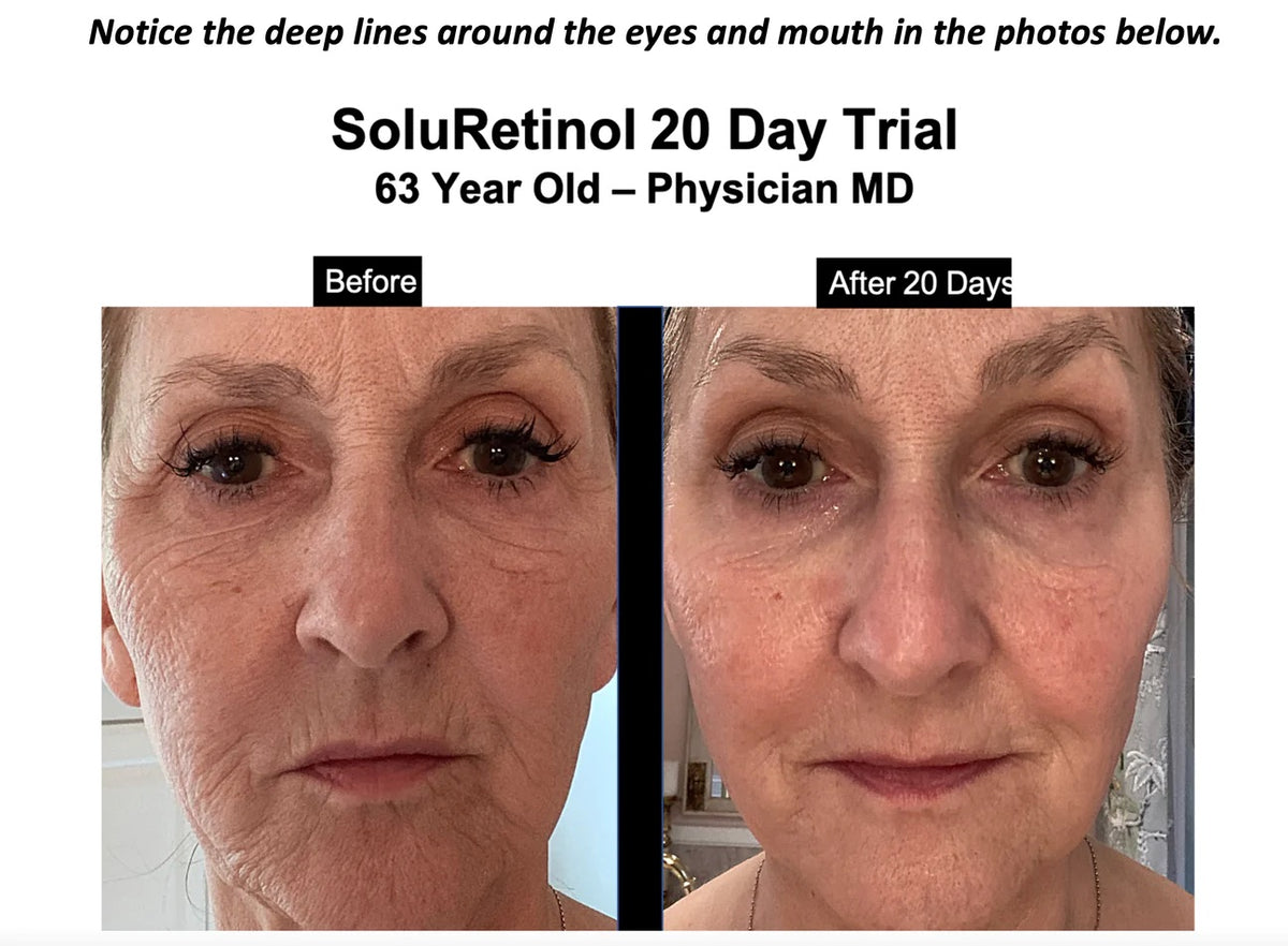 SOLURETINOL